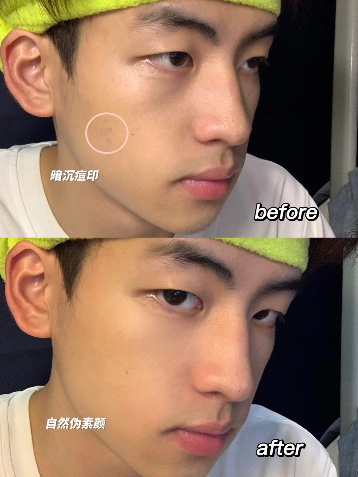 男士三支裝遮瑕棒|局部修飾痘印與黑眼圈