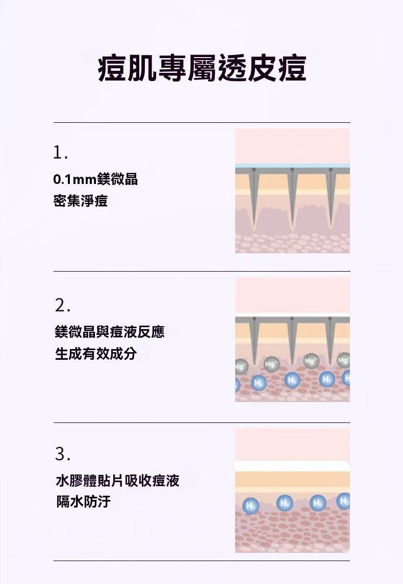 韓國微晶淨痘貼