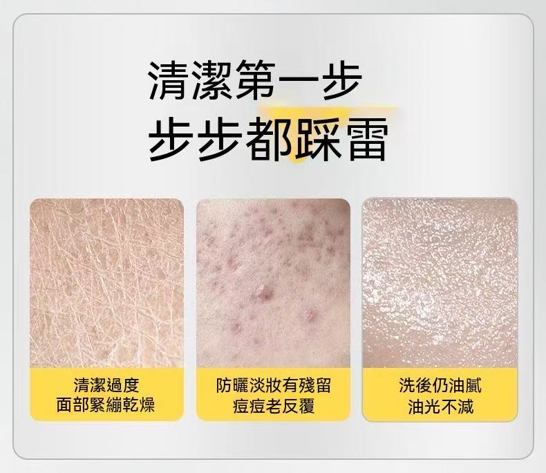 胺基酸控油祛痘潔面乳（雙肽款）