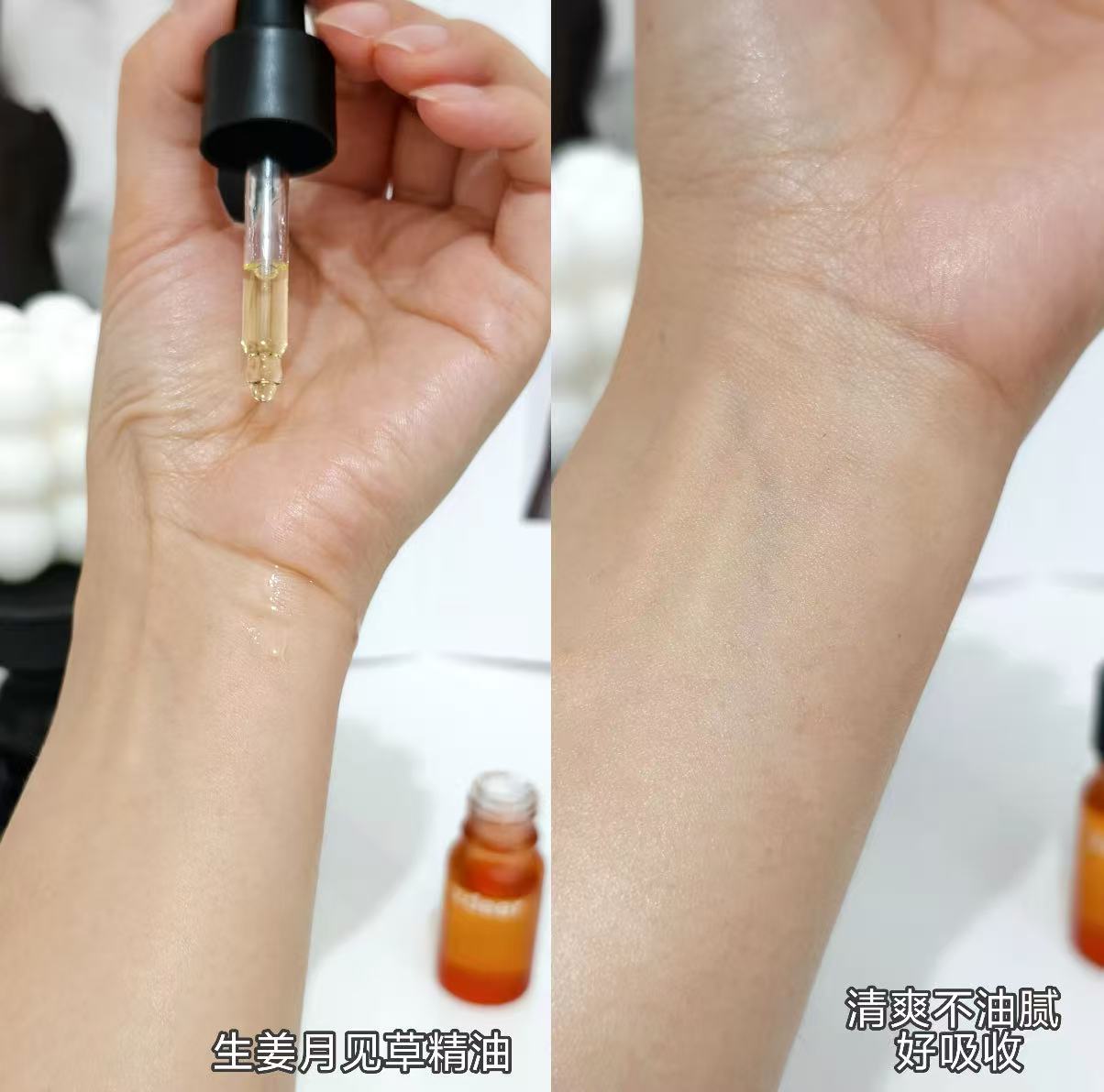 zdeer第三代紅砭電動刮刮板禮盒款