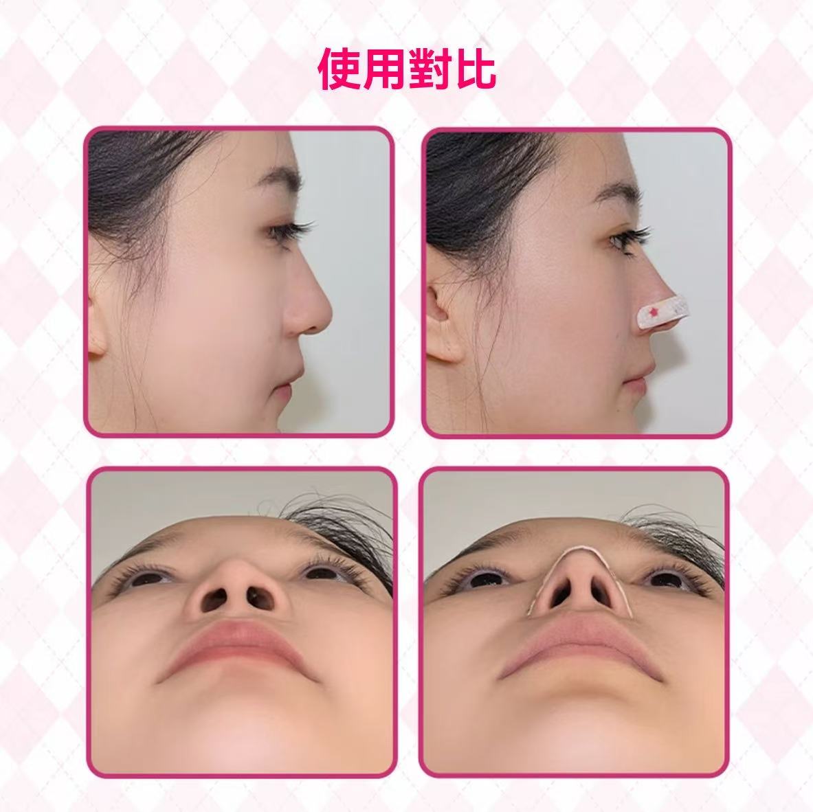 Flexible Nose Strips