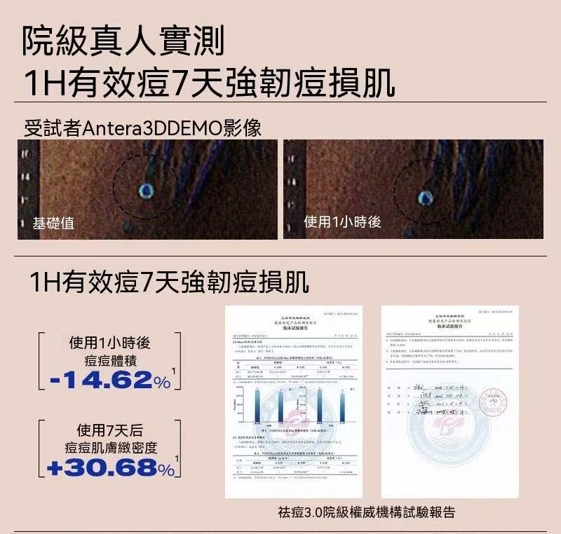3點祛痘精華7ml-3.0 淡化紅印水楊酸淨痘癟痘GC