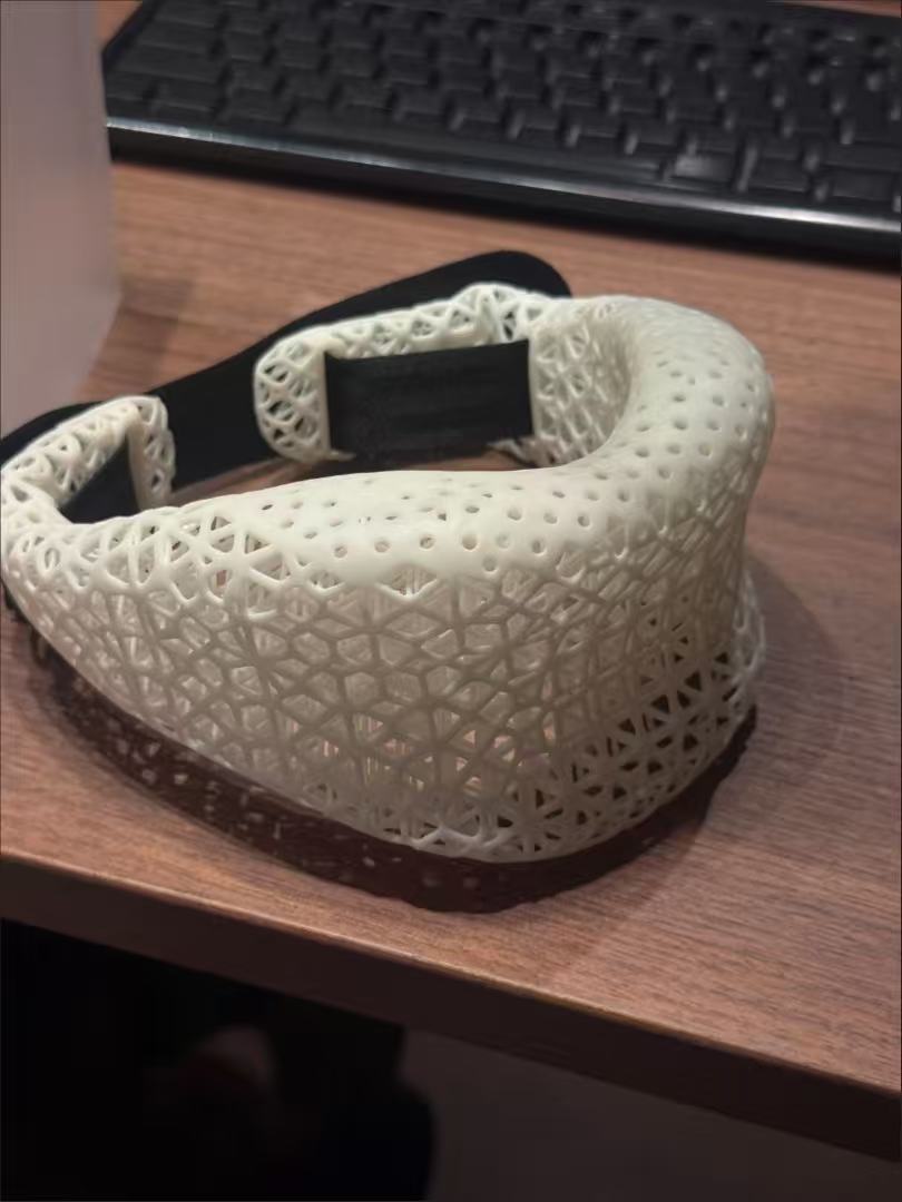 3D Printed Neck Brace to Prevent Head Tilting - Fixed, Breathable Support Neck Collar