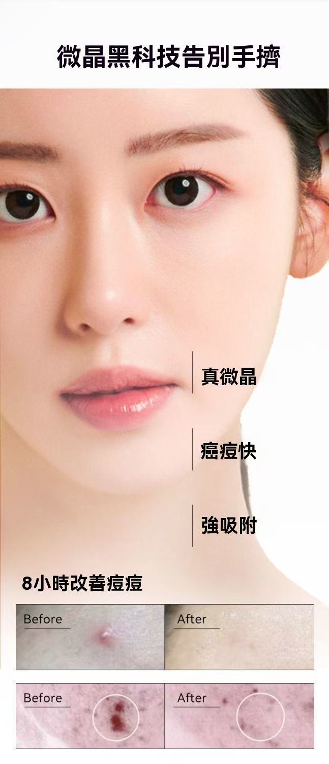 韓國微晶淨痘貼