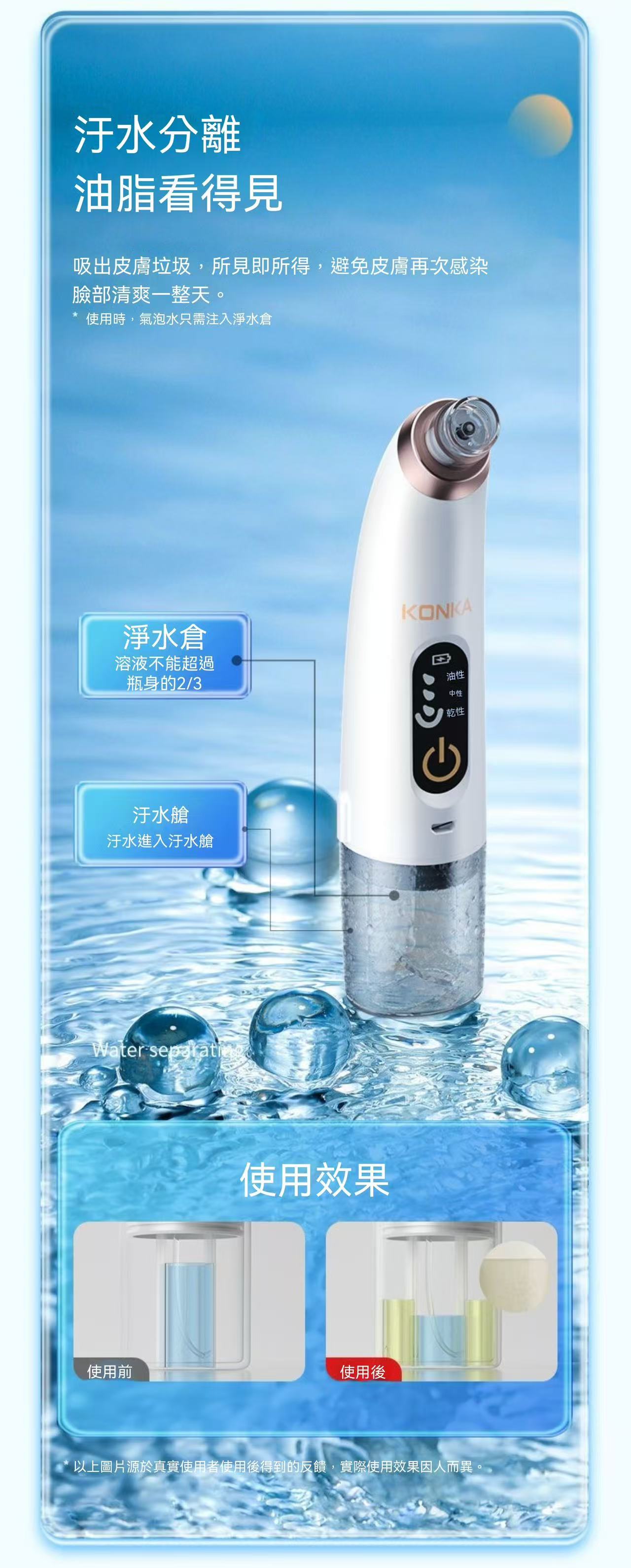 （黑頭收割機）小氣泡吸黑頭儀
