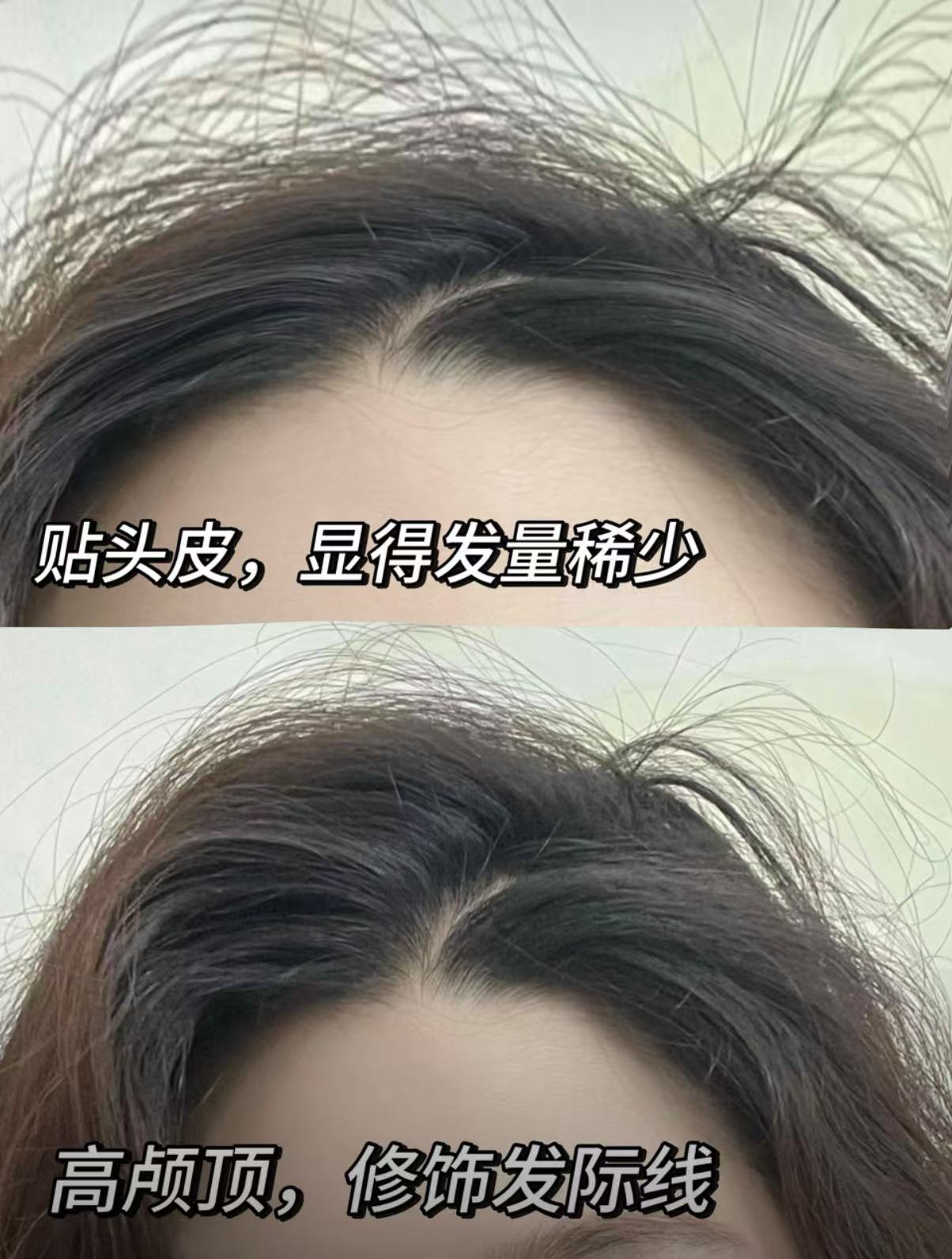 無線加熱高顱頂蓬鬆髮根夾