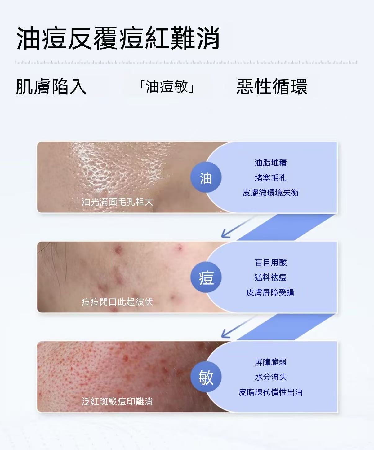 Acne Clarifying Serum 2.0 (Upgraded)