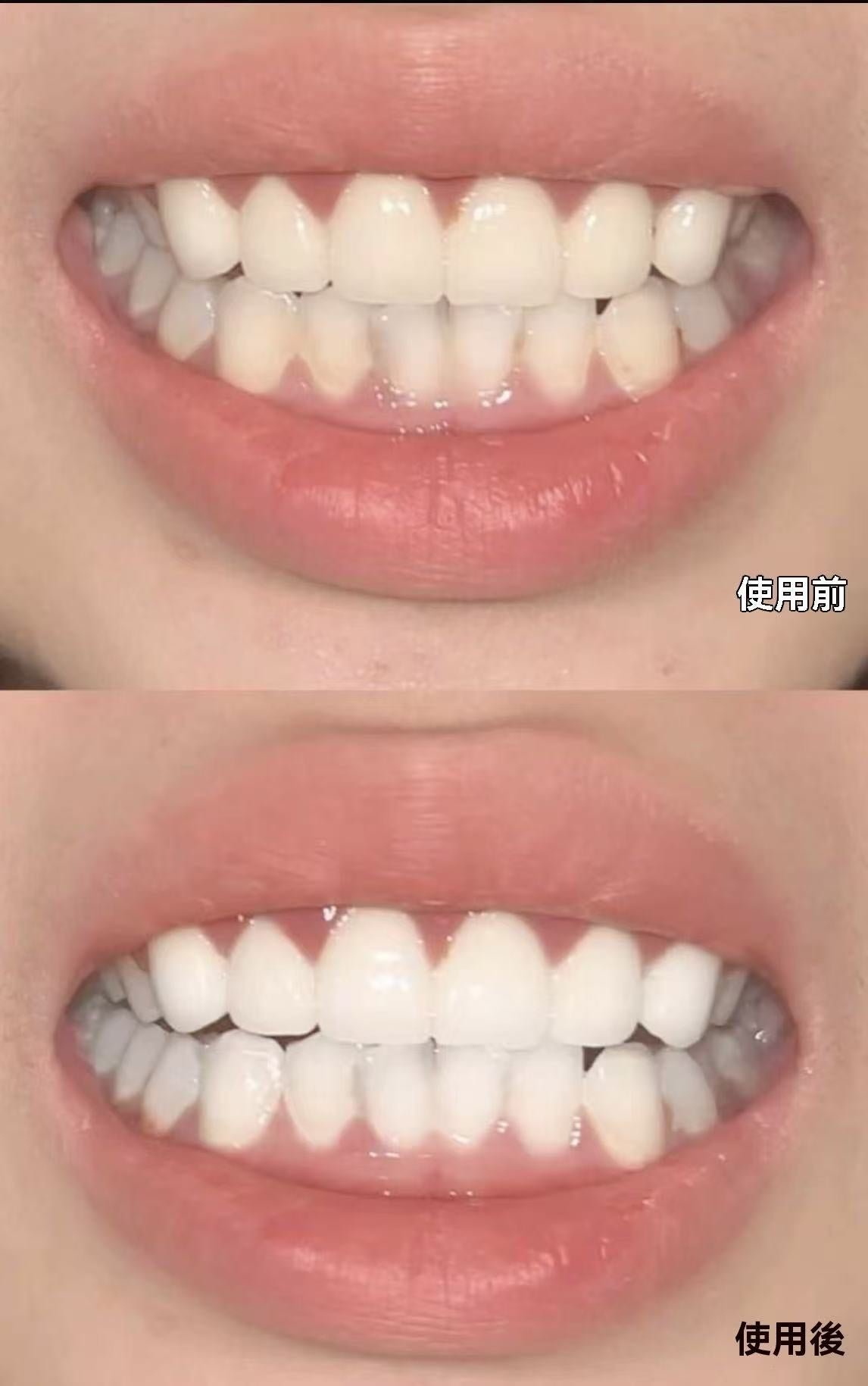 insmile白月光牙膜凝膠