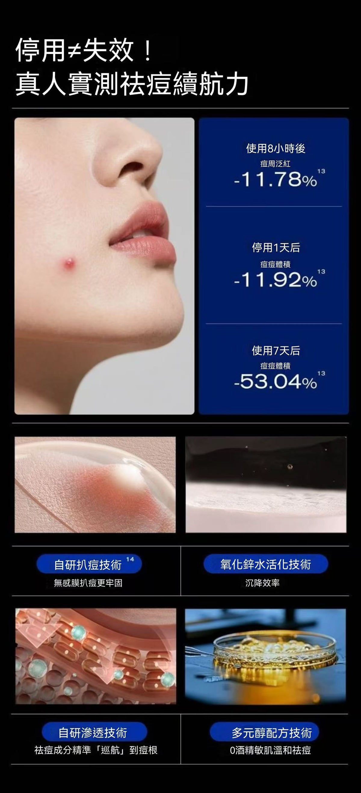 3點祛痘精華7ml-3.0 淡化紅印水楊酸淨痘癟痘GC