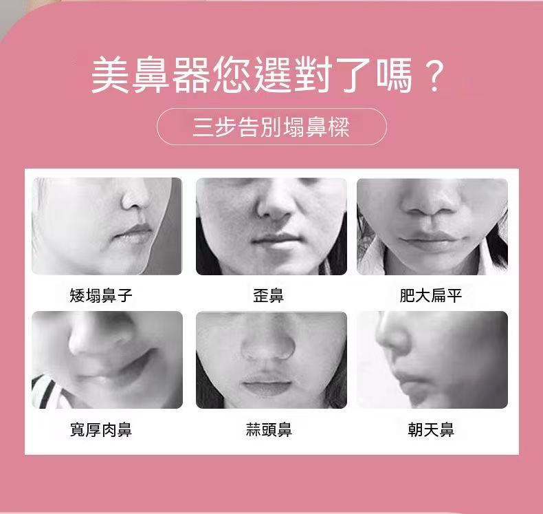 美鼻器美鼻夾 鼻梁矯正器 鼻翼縮小神器