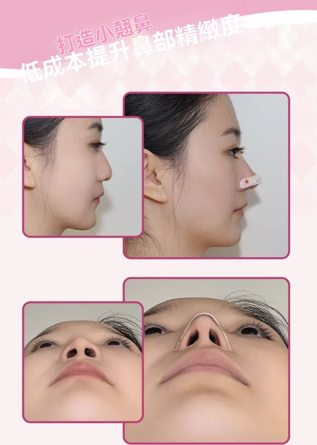Flexible Nose Strips