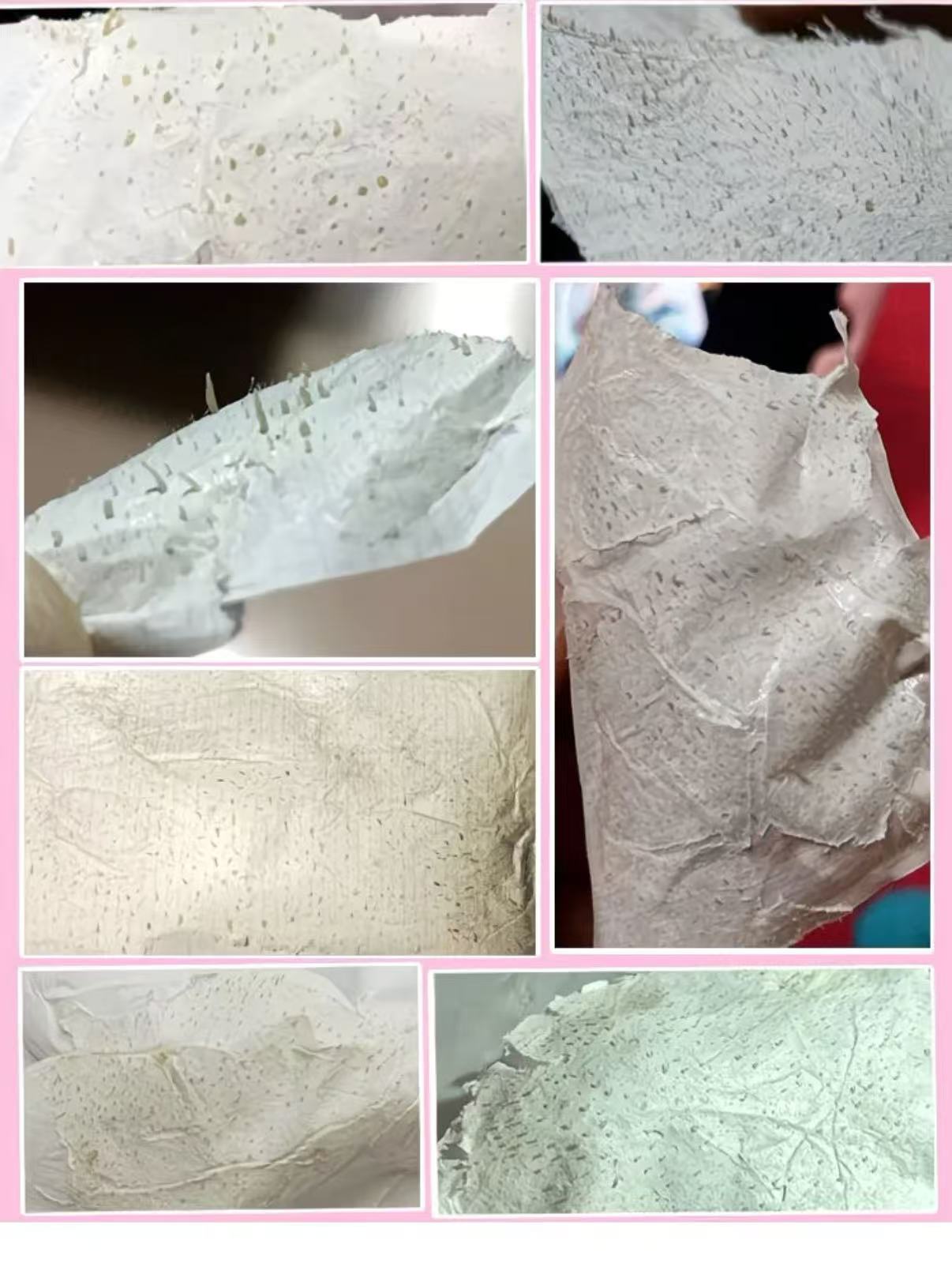 Thai Aloe Vera Blackhead Remover