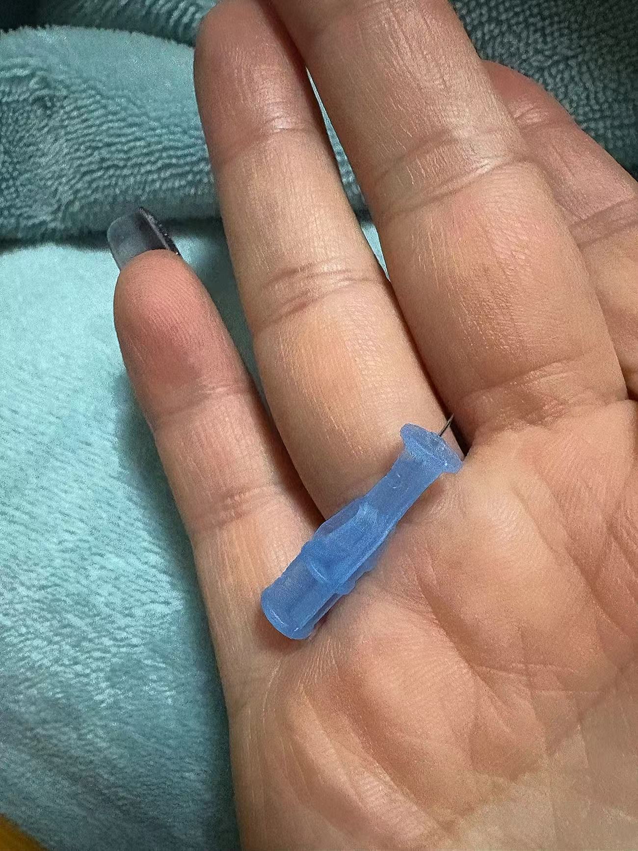 Single-use acne needle (alcohol + iodophor wipes included)