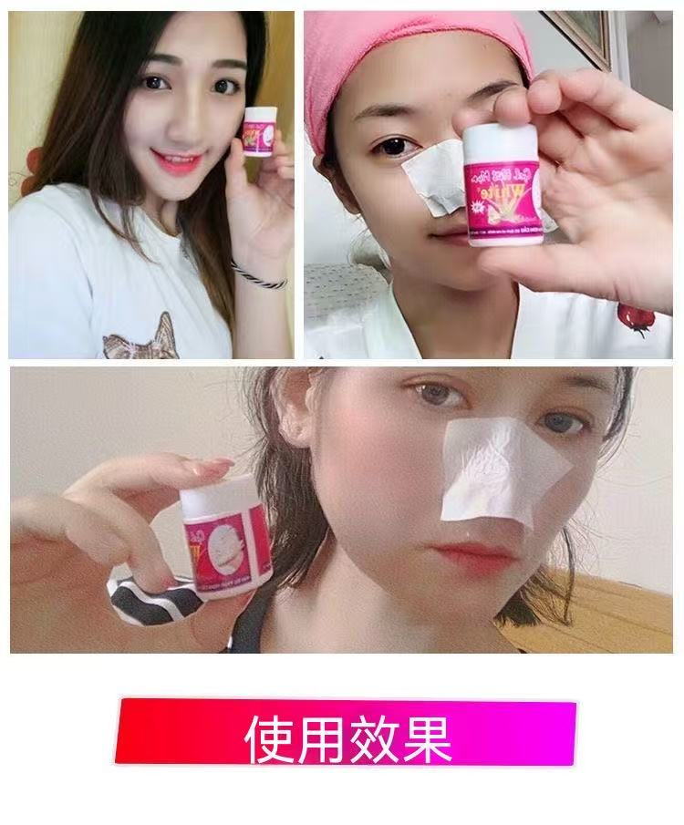 Thai Aloe Vera Blackhead Remover