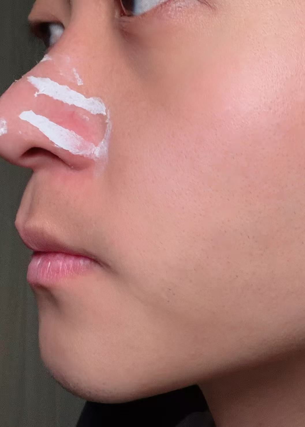 Thai Aloe Vera Blackhead Remover
