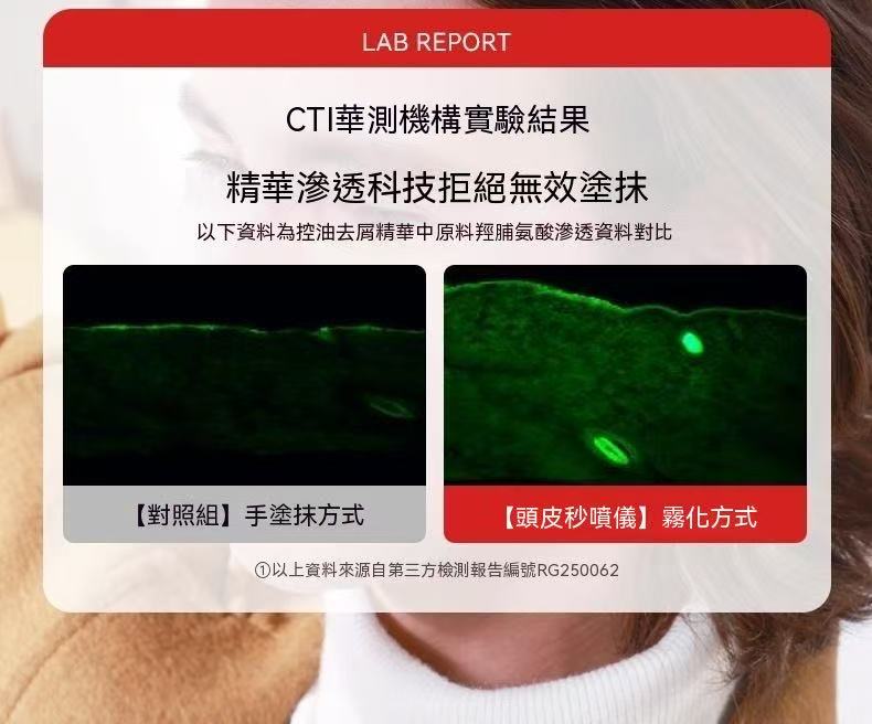 頭皮秒噴儀（米諾上液器）