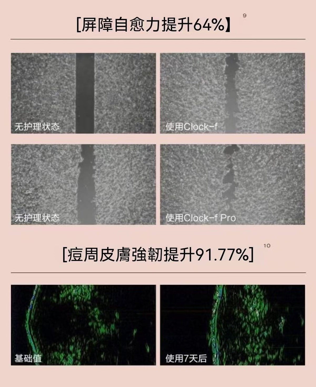 3點祛痘精華7ml-3.0 淡化紅印水楊酸淨痘癟痘GC
