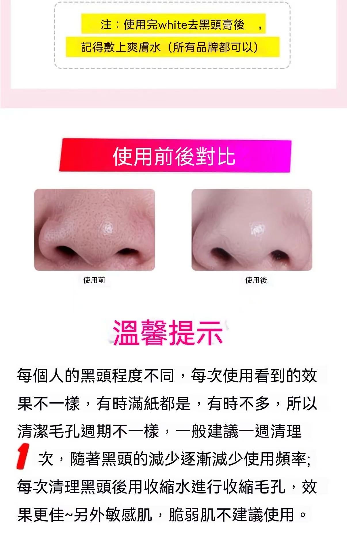 Thai Aloe Vera Blackhead Remover