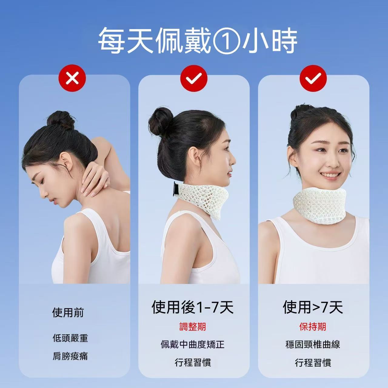 3D Printed Neck Brace to Prevent Head Tilting - Fixed, Breathable Support Neck Collar